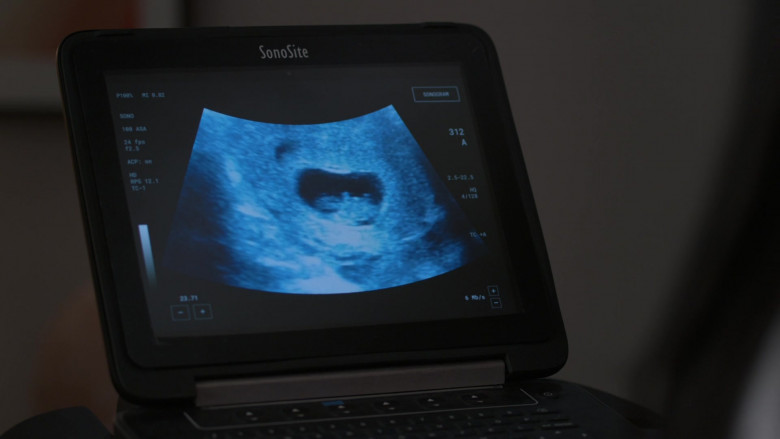 SonoSite Ultrasound Machine in The Good Doctor S04E13 TV Show (2)