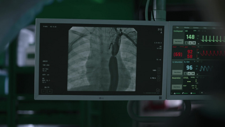 LG Medical Monitors in The Good Doctor S06E19 Half Measures (2023)