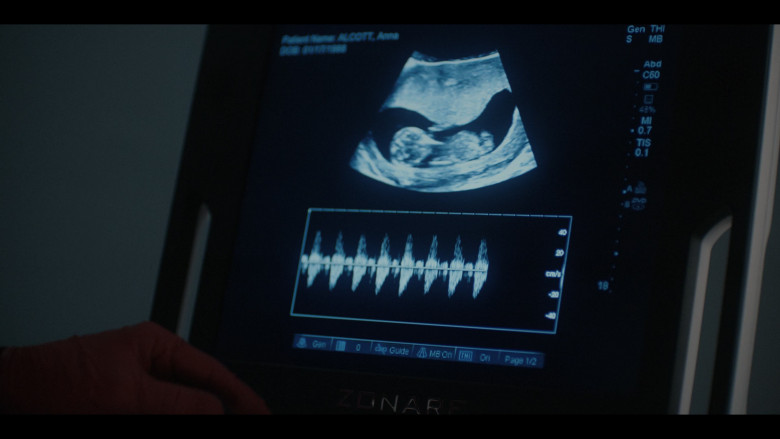 Zonare Medical Systems Ultrasound in American Horror Story: Delicate S12E04 "Vanishing Twin" (2023) - 414224